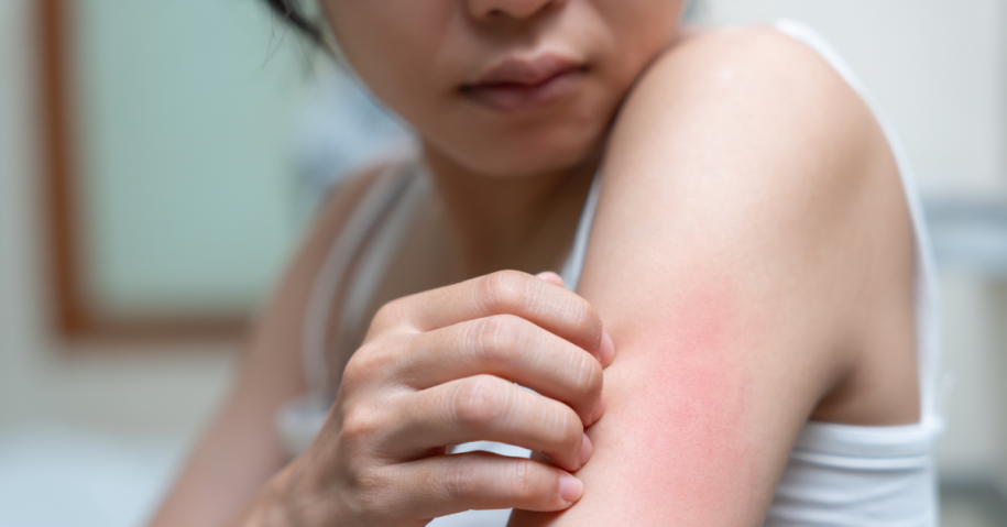 Woman scratching at the beginnings of meth sores on her bicep after using methamphetamine